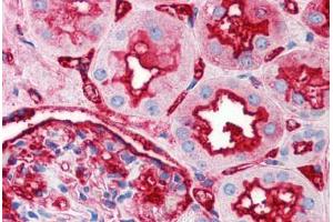 Human Kidney (formalin-fixed, paraffin-embedded) stained with TNFRSF12A antibody ABIN214532 at 2. (TNFRSF12A anticorps)