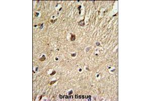 Formalin-fixed and paraffin-embedded human brain tissue reacted with BGN Antibody , which was peroxidase-conjugated to the secondary antibody, followed by DAB staining. (Biglycan anticorps  (AA 148-176))
