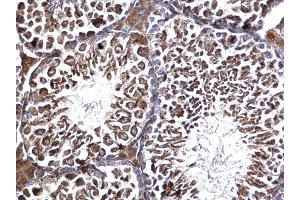 IHC-P Image Edc3 antibody [N2C2], Internal detects Edc3 protein at cytosol on mouse testis by immunohistochemical analysis. (EDC3 anticorps  (Internal Region))