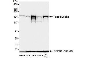 Western Blotting (WB) image for anti-Topo IIalpha (AA 650-700) antibody (ABIN7795794) (Recombinant Topo IIalpha (AA 650-700) anticorps)