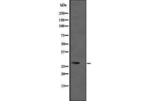 Western blot analysis of UBE2R2 expression in Jurkat whole cell lysate ,The lane on the left is treated with the antigen-specific peptide. (UBE2R2 anticorps)