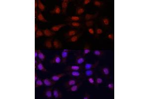 Immunofluorescence analysis of HeLa cells using N5-Methylcytidine antibody (ABIN1678489, ABIN3016020, ABIN3016022 and ABIN6219497) at dilution of 1:100. (5-Methylcytosine anticorps)