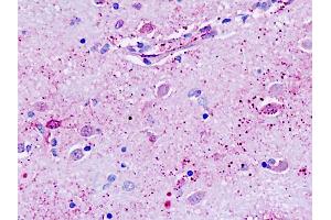 Human, Brain, neurons: Formalin-Fixed Paraffin-Embedded (FFPE)