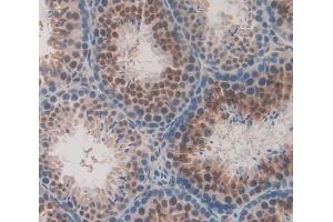 Used in DAB staining on fromalin fixed paraffin- embedded Kidney tissue