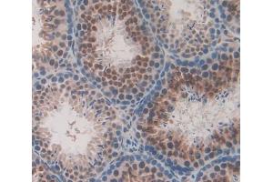Used in DAB staining on fromalin fixed paraffin- embedded Kidney tissue (UXT anticorps  (AA 11-157))