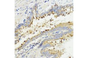 Immunohistochemistry of paraffin-embedded rat lung using IGF1 antibody (ABIN6134370, ABIN6142231, ABIN6142233 and ABIN6215544) at dilution of 1:100 (40x lens).