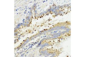 Immunohistochemistry of paraffin-embedded rat lung using IGF1 antibody (ABIN6134370, ABIN6142231, ABIN6142233 and ABIN6215544) at dilution of 1:100 (40x lens). (IGF1 anticorps  (AA 50-150))