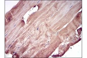 Immunohistochemical analysis of paraffin-embedded human muscle tissues using PRL mouse mAb with DAB staining.