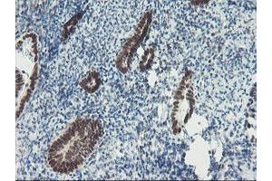 anti-TP53RK Binding Protein (TPRKB) antibody