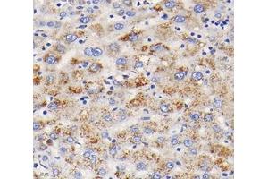 Immunohistochemistry analysis of paraffin-embedded human liver using,TFR2 (ABIN7075965) at dilution of 1: 400 (Transferrin Receptor 2 anticorps)