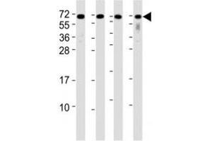 Western blot testing of CD63 antibody at 1:2000 dilution.