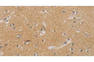 Immunohistochemistry of paraffin-embedded Human brain using NDRG1 Polyclonal Antibody at dilution of 1:70