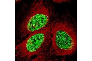 Immunofluorescence staining of U-2 OS cell with antibody shows specific staining in the nucleoplasm in green. (SMCHD1 anticorps)