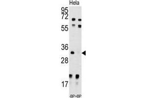 Western blot analysis of anti-UCK2 Antibody (N-term) pre-incubated with and without blocking peptide in Hela cell line lysate.
