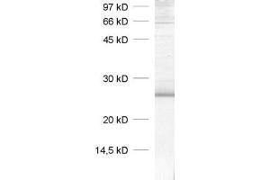 dilution: 1 : 1000, sample: rat brain homogenate (Caveolin-1 anticorps  (AA 1-17))