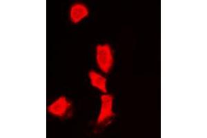 Immunofluorescent analysis of Histone Deacetylase 6 staining in Jurkat cells. (HDAC6 anticorps  (N-Term))