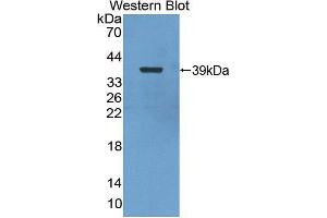 Western blot analysis of the recombinant protein. (Nuclear Factor kappa B2 (AA 37-342) anticorps)