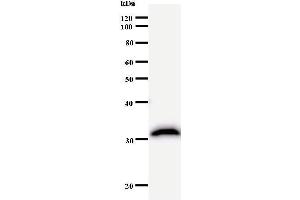 Western Blotting (WB) image for anti-CREB Binding Protein (CREBBP) antibody (ABIN932995) (CBP anticorps)