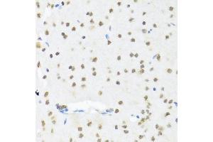 Immunohistochemistry of paraffin-embedded mouse brain using SET antibody at dilution of 1:100 (x40 lens). (SET/TAF-I anticorps)