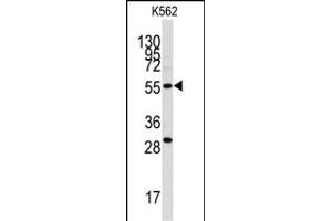 Western blot analysis of anti-CLIC5 Antibody (ABIN391843 and ABIN2841681) in K562 cell line lysates (35 μg/lane). (CLIC5 anticorps)