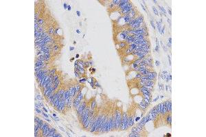 Immunohistochemistry (IHC) image for anti-Pepsinogen C (PGC) (AA 100-200) antibody (ABIN3016695)