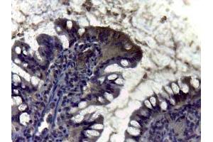 Immunohistochemistry of Rabbit anti Carbonic Anhydrase II antibody Tissue: intestine Staining: diffuse positivity of enzyma Carbonic Anidrase II in brush border of villus