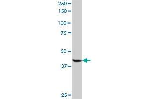 ACOX2 MaxPab rabbit polyclonal antibody. (Acox2 anticorps  (AA 1-681))