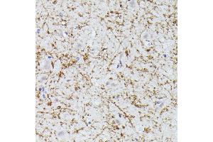 Immunohistochemistry of paraffin-embedded human brain using CLN8 antibody (ABIN7266285) at dilution of 1:300 (40x lens). (CLN8 anticorps)