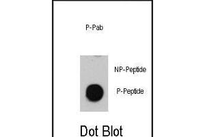 Dot blot analysis of anti-Phospho-ATM-p Antibody (ABIN389888 and ABIN2839734) on nitrocellulose membrane. (ATM anticorps  (pSer1981))