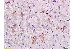 Formalin-fixed and paraffin embedded rat brain tissue labeled with Anti-APC/Adenomatous Polyposis Coli Polyclonal Antibody, Unconjugated (ABIN702550) at 1:200 followed by conjugation to the secondary antibody, (SP-0023), and DAB staining