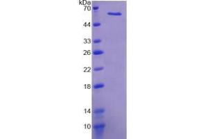 SDS-PAGE (SDS) image for Kininogen (High Molecular Weight) (AA 268-540) protein (His tag,SUMO Tag) (ABIN3209913)