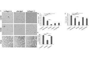 COL6 promotes lung epithelial cell spreading.