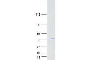 Validation with Western Blot