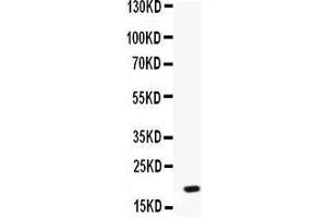 Western blot analysis of NAP2 expression in MCF-7 whole cell lysates (lane 1). (CXCL7 anticorps  (AA 55-128))