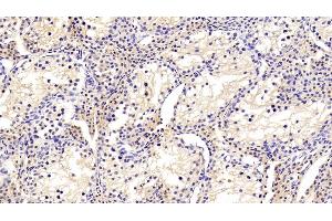 Detection of TF in Porcine Testis Tissue using Polyclonal Antibody to Transferrin (TF) (Transferrin anticorps  (AA 361-683))