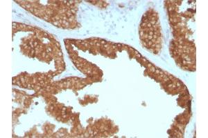 Ret Proto-Oncogene anticorps  (AA 702-848)