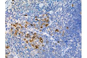 ABIN6255252 and ABIN6267093 at 1/100 staining Mouse spleen tissue by IHC-P. (ATG13 anticorps  (pSer355))