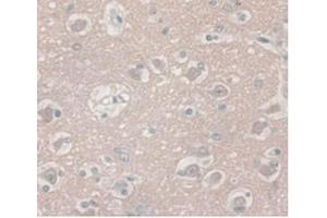 IHC-P analysis of Human Brain Tissue, with DAB staining. (ENO2/NSE anticorps  (AA 2-285))