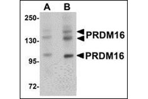 Western blot analysis of PRDM16 in rat brain tissue lysate with AP30689PU-N PRDM16 antibody at (A) 1 and (B) 2 μg/ml. (PRDM16 anticorps  (C-Term))