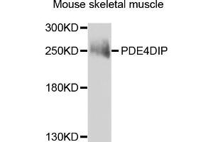 Western blot analysis of extracts of mouse skeletal muscle, using PDE4DIP antibody. (PDE4DIP anticorps)
