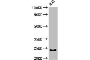 Western Blot Positive WB detected in: 293 whole cell lysate All lanes: HMGB3 antibody at 7 μg/mL Secondary Goat polyclonal to rabbit IgG at 1/50000 dilution Predicted band size: 23 kDa Observed band size: 23 kDa (HMGB3 anticorps  (AA 1-103))