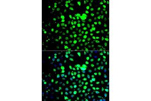 Immunofluorescence analysis of A549 cell using ZBTB25 antibody. (ZBTB25 anticorps)
