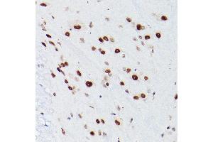 Immunohistochemistry of paraffin-embedded Mouse spinal cord using NSUN5 antibody ( ABIN7268955) at dilution of 1:100 (40x lens). (NSUN5 anticorps  (AA 277-466))
