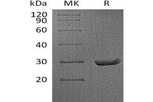 Western Blotting (WB) image for Amyloid P Component, Serum (APCS) protein (His tag) (ABIN7320740)