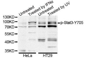 Western blot analysis of extracts of HT-29 cell line, using Phospho-Stat3-Y705 antibody. (STAT3 anticorps  (pTyr705))