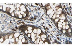 ABIN6272628 at 1/100 staining Rat colon tissue by IHC-P.