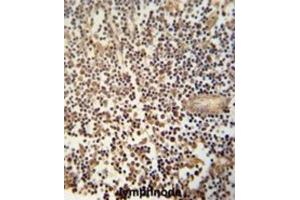 Immunohistochemistry (IHC) image for anti-DNA Segment, MCA1, Multiple CA Repeat 1 (MCA1) antibody (ABIN3002773) (MCA1 anticorps)