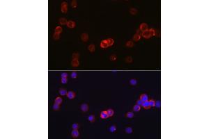 Immunofluorescence analysis of TF-1 cells using J Rabbit pAb (ABIN6134375, ABIN6142642, ABIN6142643 and ABIN6213974) at dilution of 1:50 (40x lens). (JAK3 anticorps  (AA 750-850))
