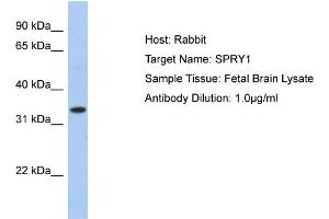 WB Suggested Anti-SPRY1 Antibody Titration:  0.
