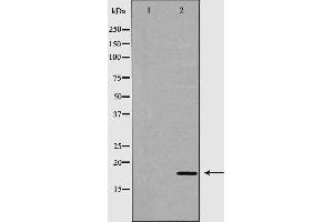 Western blot analysis of extracts of human stomach tissue, using TNNC1 antibody. (TNNC1 anticorps  (Internal Region))